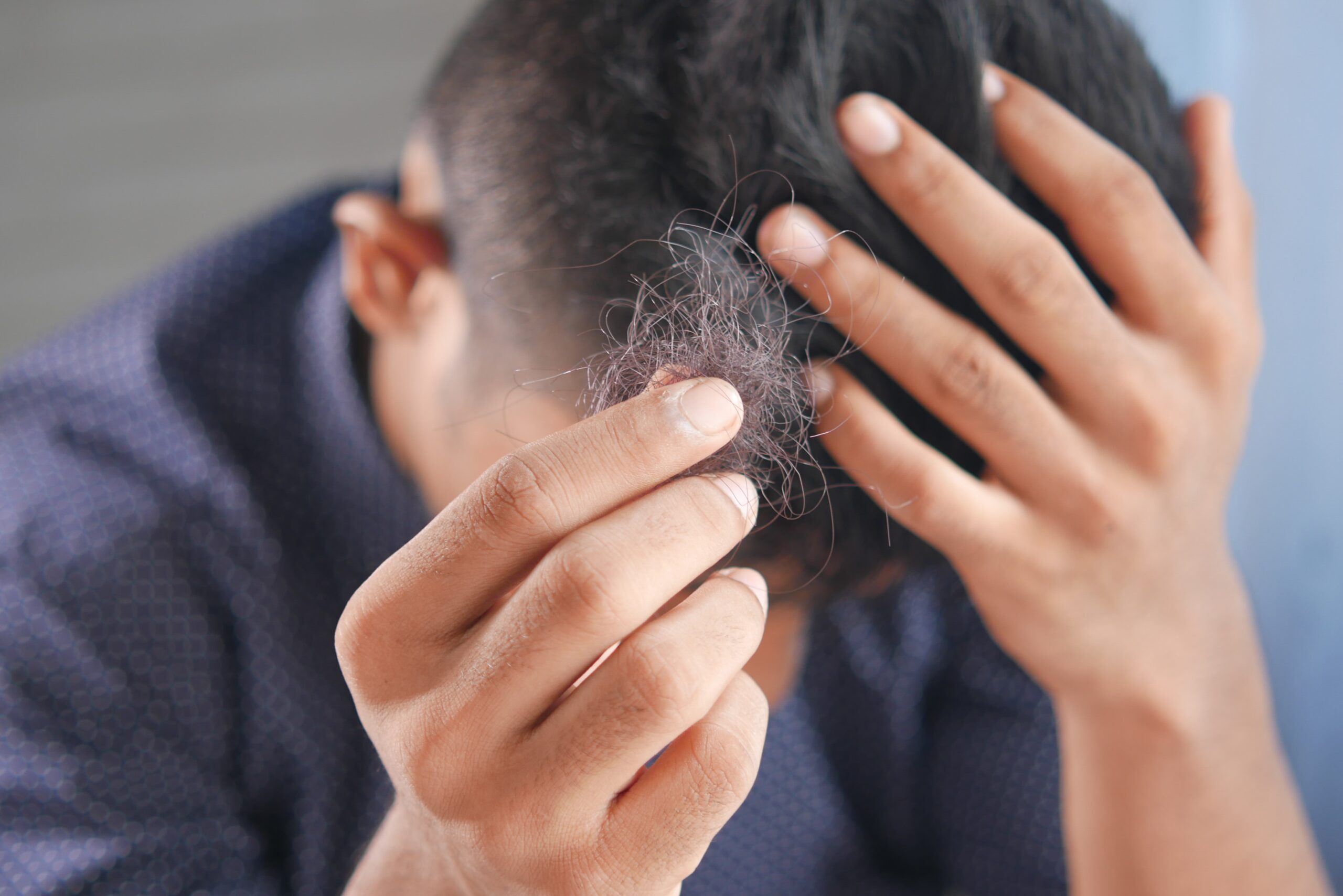 Meu cabelo está caindo muito. O que fazer? - Spazio Lins